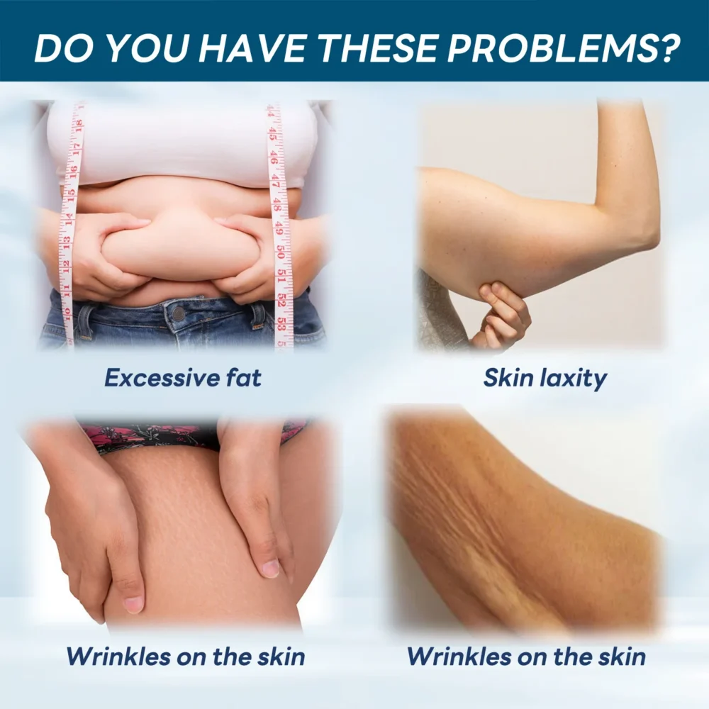 Body Whitening Cream Firming Lift Moisturize Skin Remove Thick Pores Smooth Bleaching Anti Wrinkle Tighten Melanin Bleach Cream - Image 5