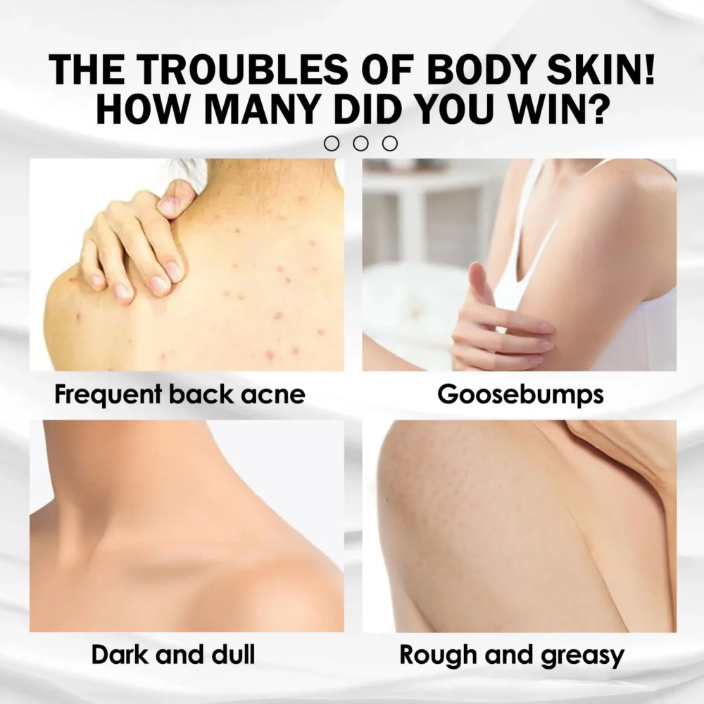 Moisturizing Cream Keratosis Follicle Pilaris Removal Shrink Pore Fade Pigmentation Whit-ening Smooth Repair Chicken Skin Cream - Image 3