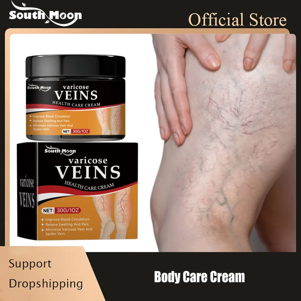 Leg Treatment Cream Reducing Varicose Veins Remove Redness Repair Phlebitis Relieves Bulge Improving Circulation Body Care Cream